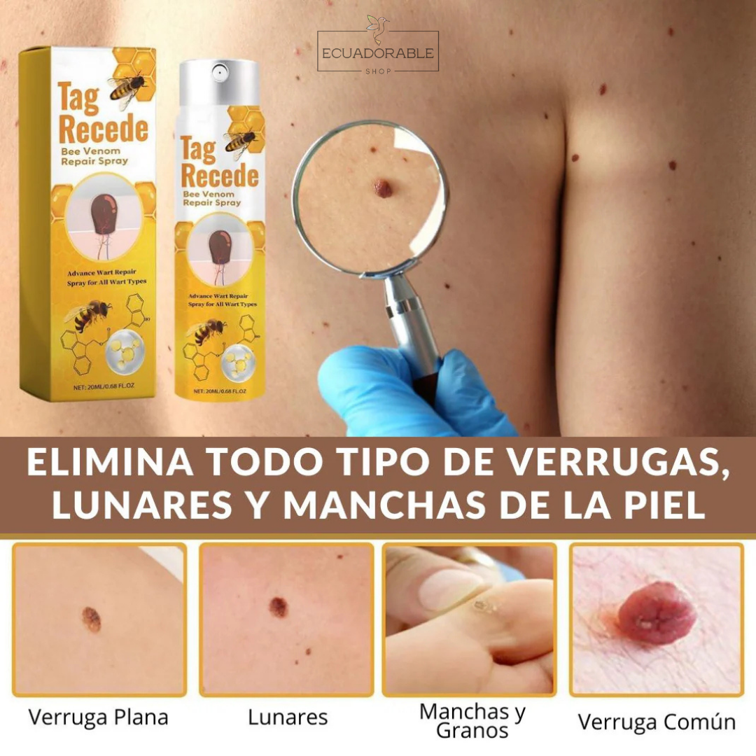 🐝Tag Recede - Despídete de las verrugas piel lisa y sin marcas